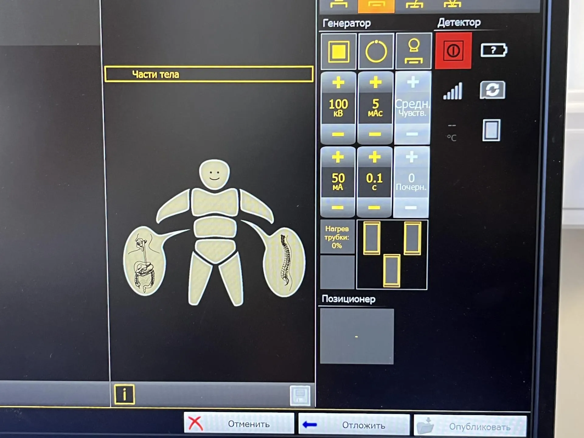 Анна Тюрюмина