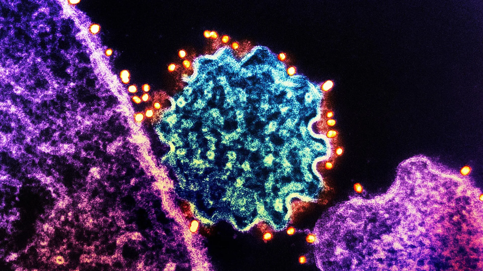 IMAGO/NIH-NIAID/IMAGE POINT FR