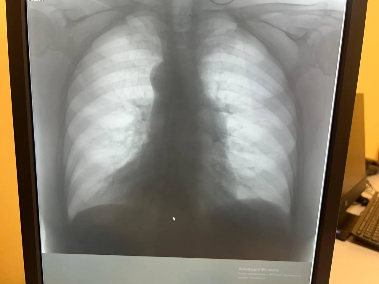 Фото:&nbsp; пресс-служба Красногорской больницы