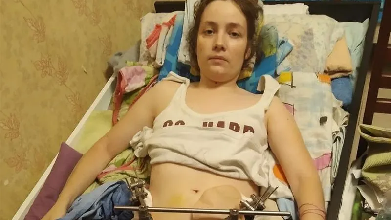 Средства для матери-одиночки, попавшей под грузовик, собирают в Долгопрудном