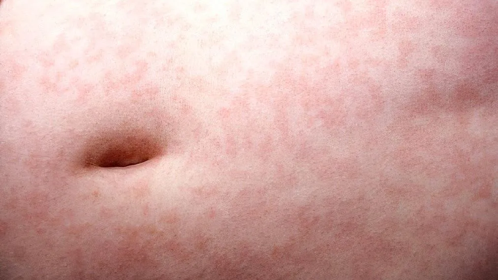 Custom Medical Stock Photo