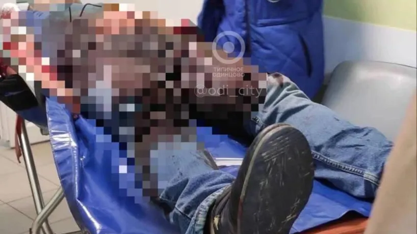 фото:Telegram-канал "Типичное Одинцово"