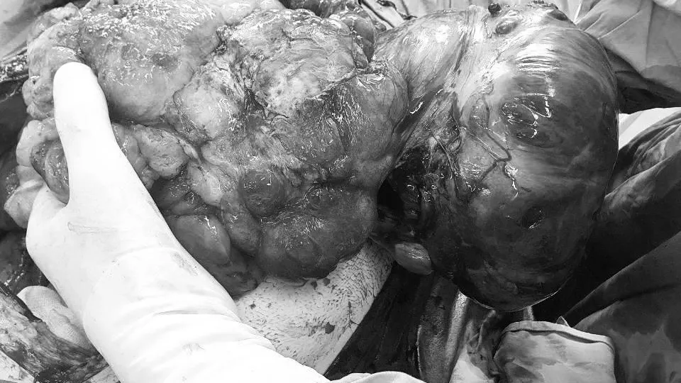 пресс-служба Министрества здравоохранения МО