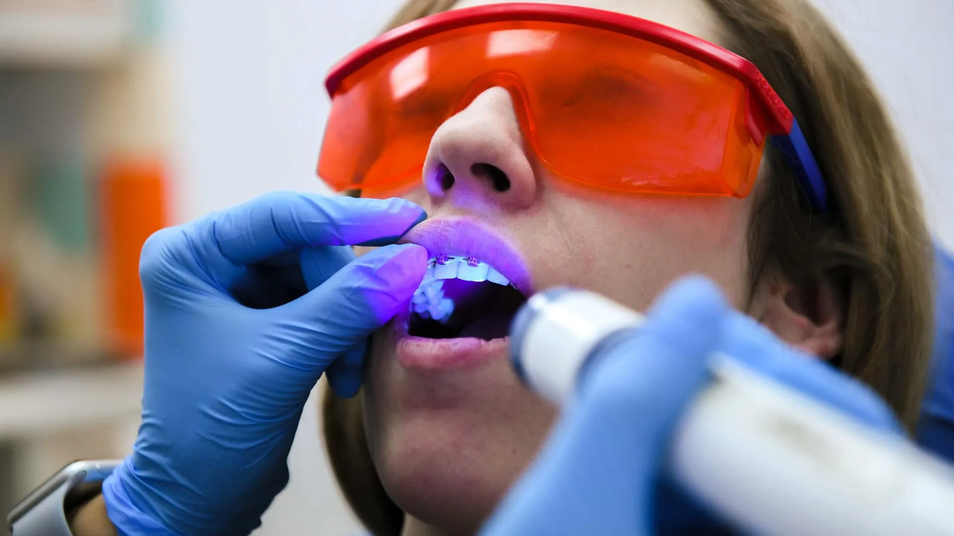 Имплантолог пояснил, почему две операции вместо одной — это больше не норма