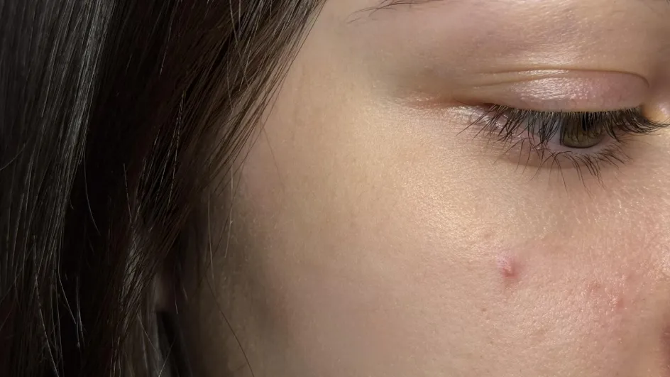 Фото: ГБУЗ МОККВД