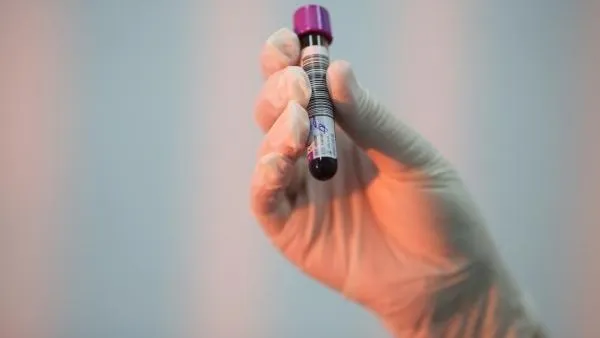 Пациентов с редкими заболеваниями крови в Подмосковье будут лечить за счет федерального бюджета