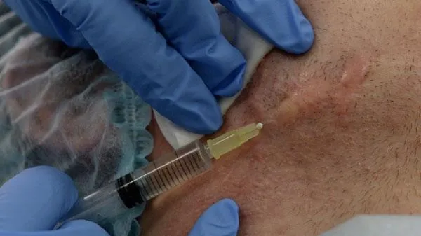 В США медик ввел смертельную дозу 25 пациентам