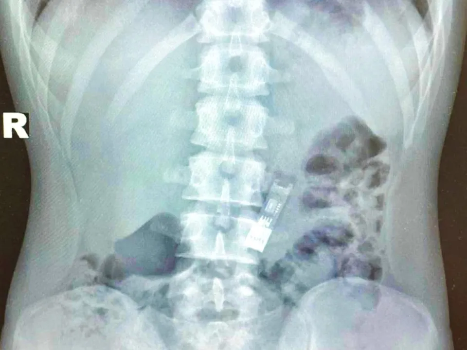 Фото: Министерство здравоохранения Московской области