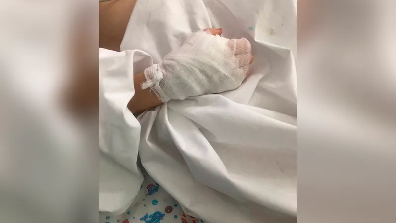 Жертва поножовщины в химкинском лицее идет на поправку