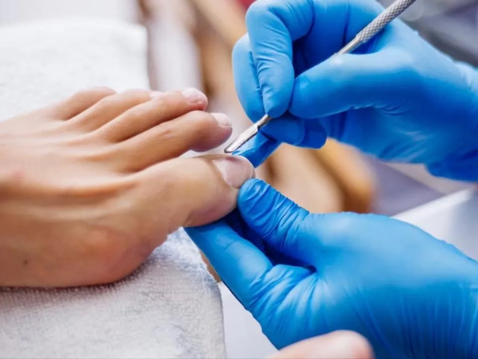 Врастание ногтей, нагноения: выяснилось, почему не стоит делать педикюр с гель-лаком в холодное время года