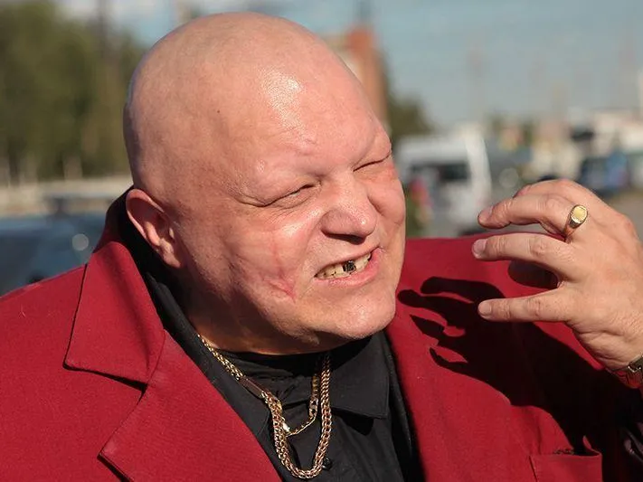 Барецкий рассказал о своем состоянии после избиения в Питере