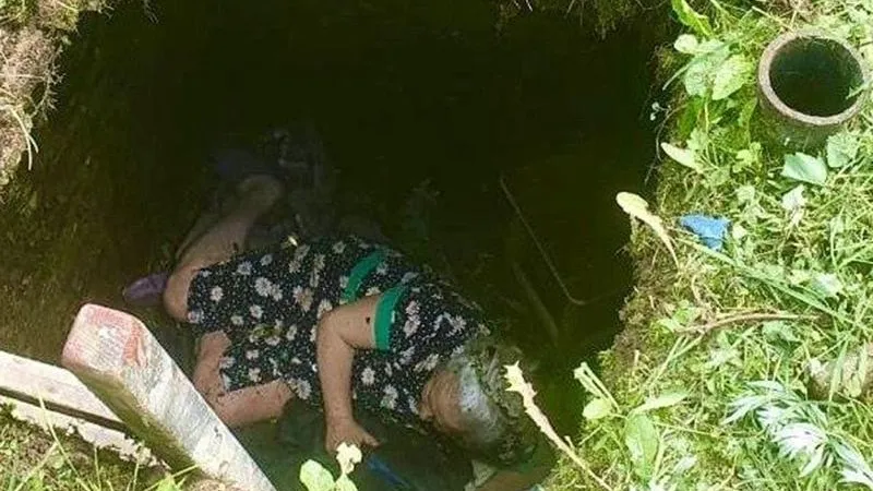 Спасатели рассказали, что делать, если человек упал в погреб