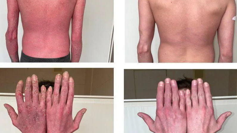 Пресс-служба Минздрава МО