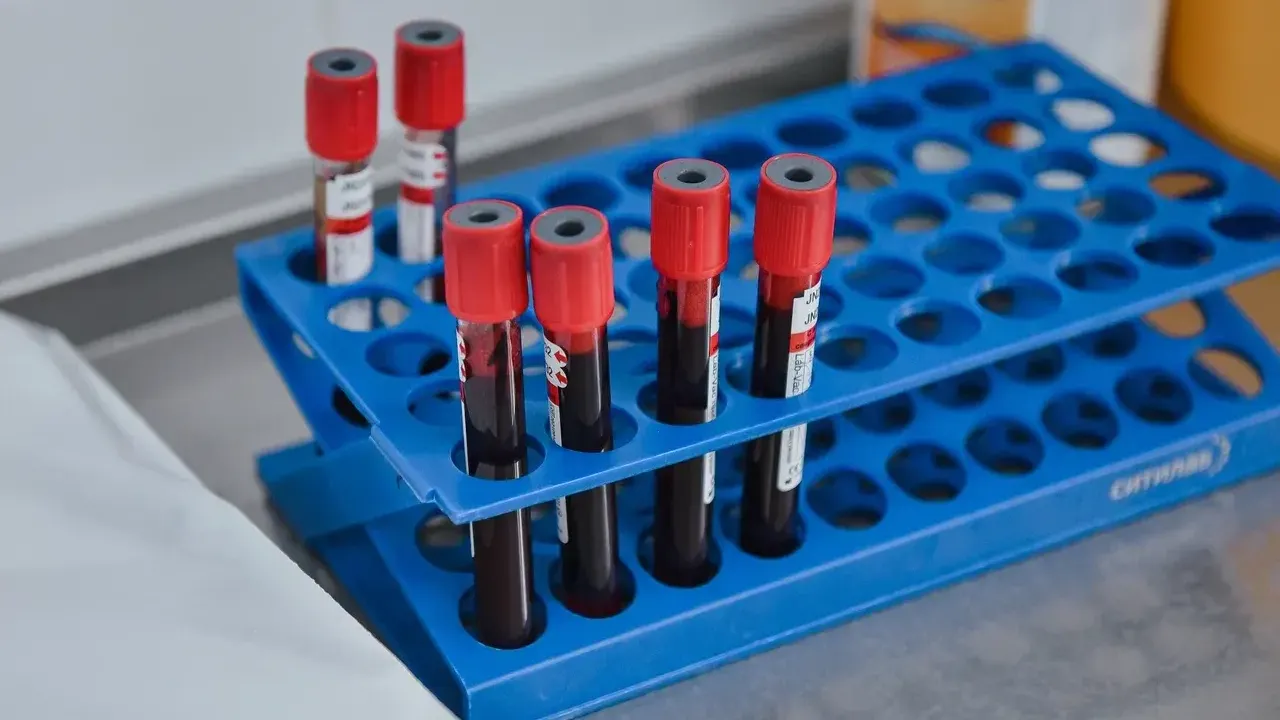 Химкинская больница