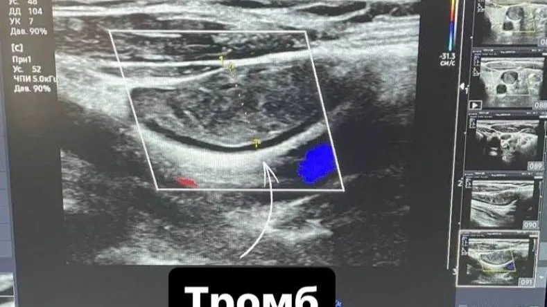 Пресс-служба Минздрава МО