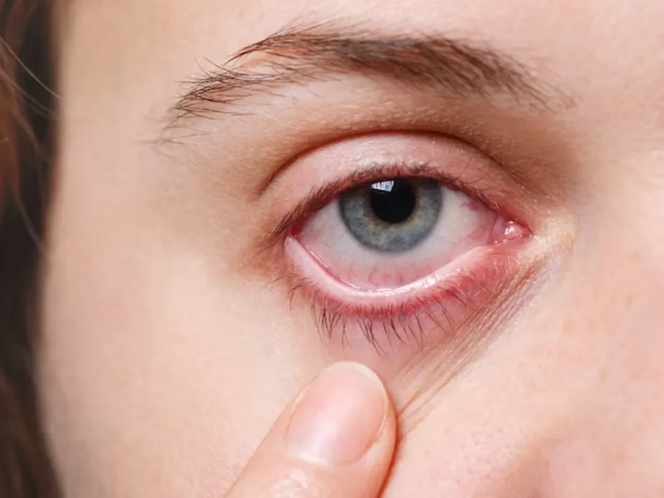 Выяснилось, к каким страшным последствиям может привести мошка в глазу