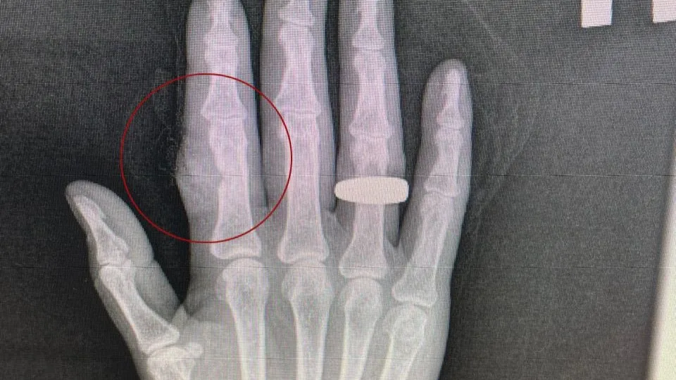 Фото: пресс-служба ступинской больницы