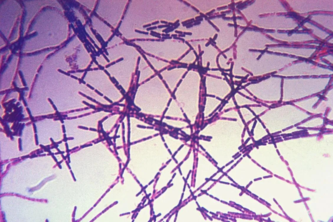 Микрофотография бацилл сибирской язвы / CDC