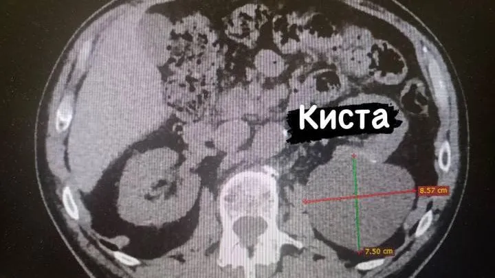 Пресс-служба Минздрава МО