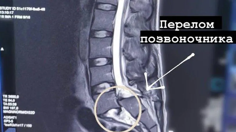 Министерство здравоохранения МО