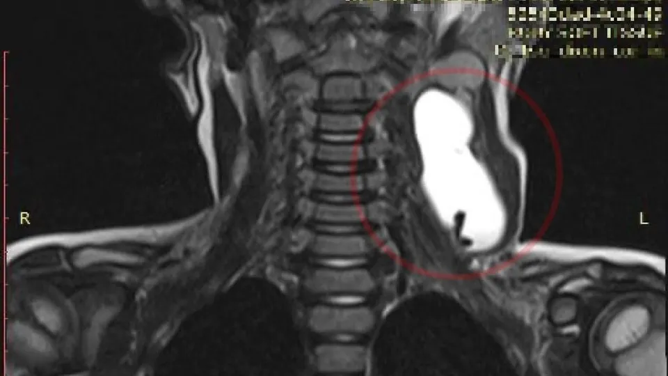 Фото: пресс-служба Минздрава МО
