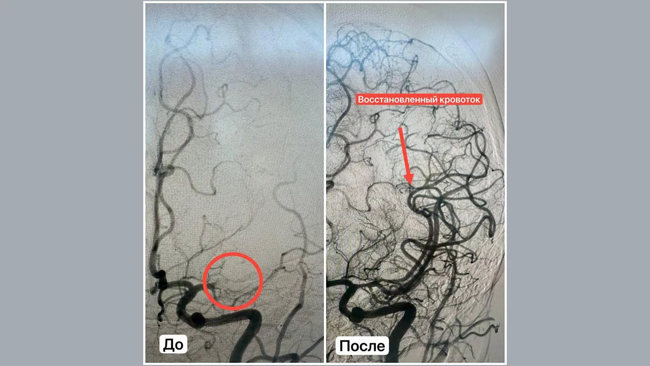 Фото: пресс-служба Ступинской КБ