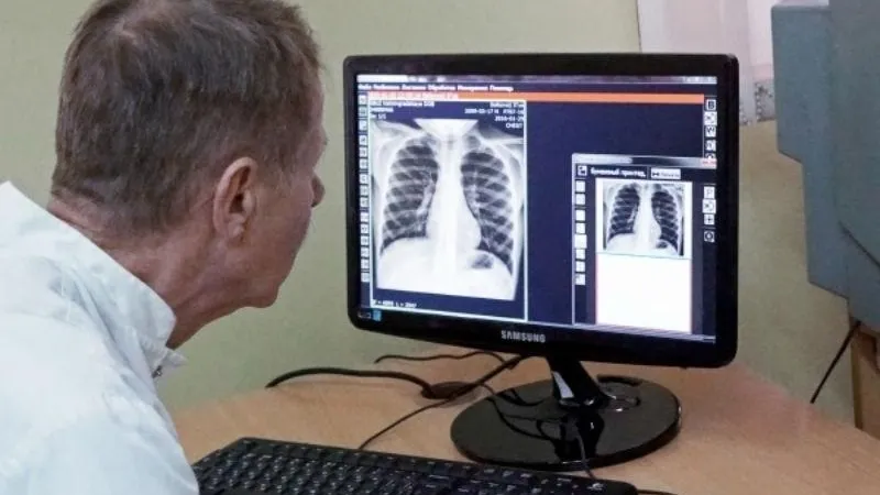 Почти на 40% снизилась смертность от болезней органов дыхания в МО