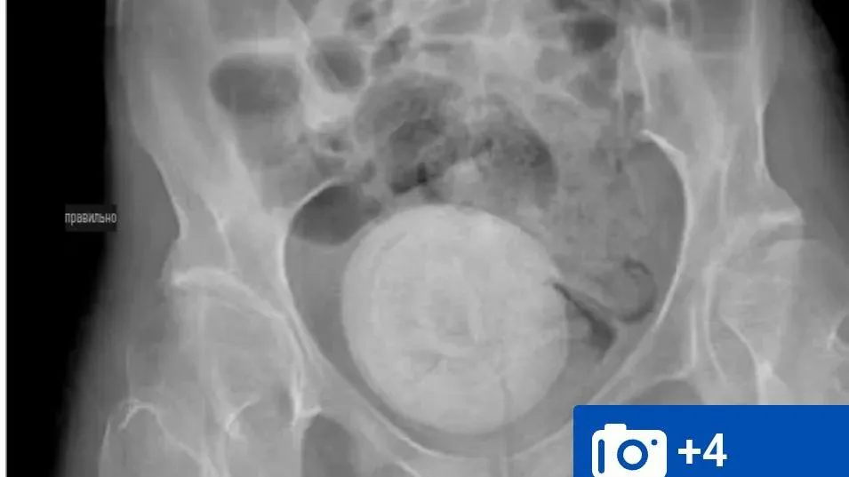 Фото: MailOnlaine Здравоохранение