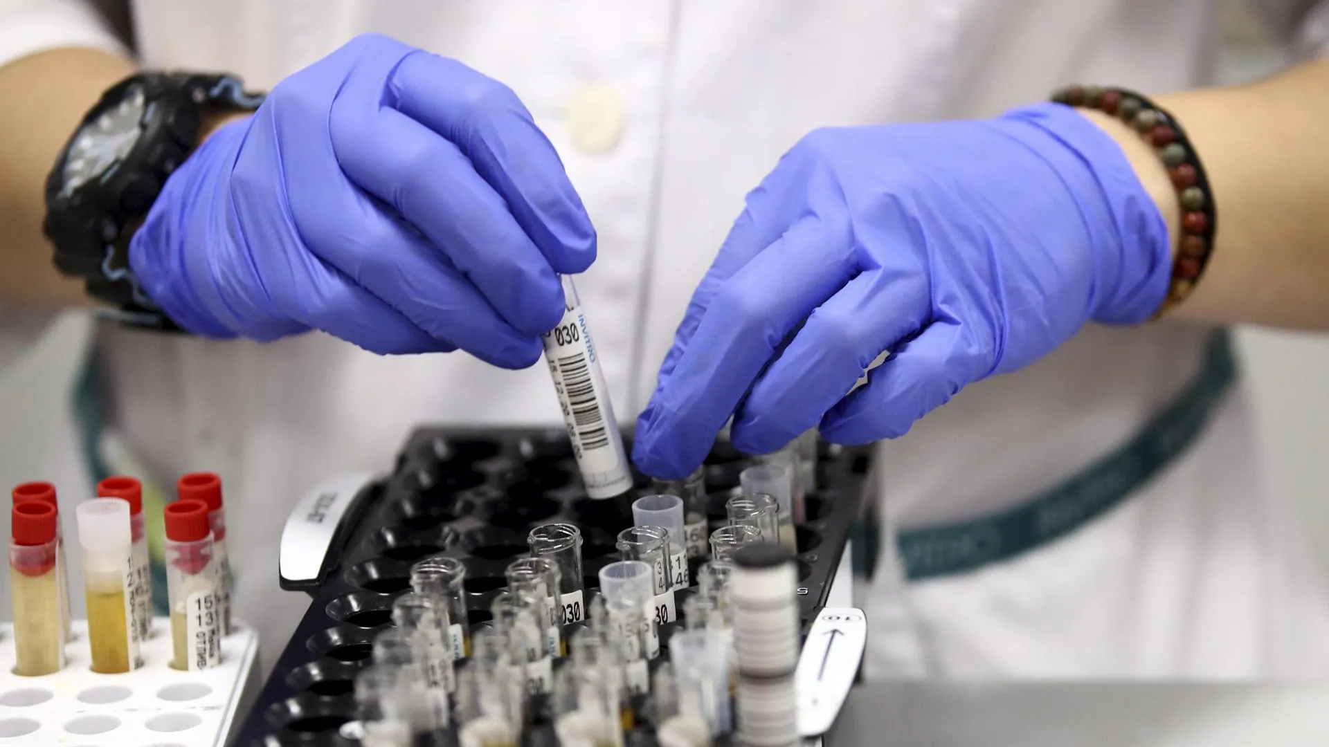 Под Воронежем был обнаружен очаг сибирской язвы