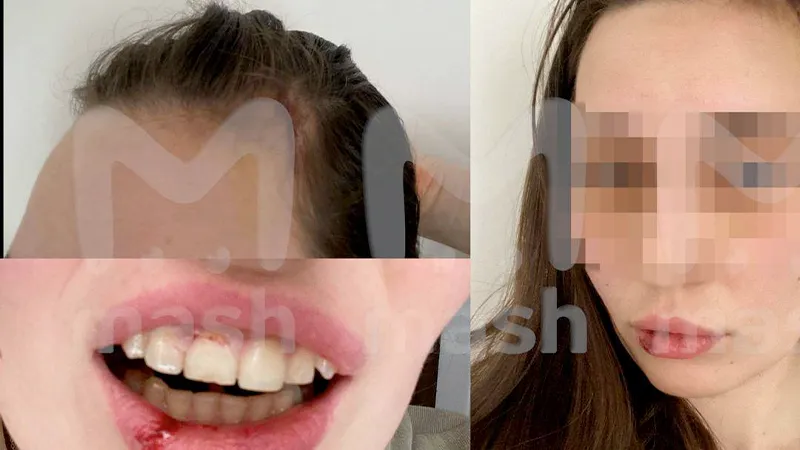 «Стала меня душить»: Сара Окс рассказала свою версию конфликта в фитнес-клубе Одинцова