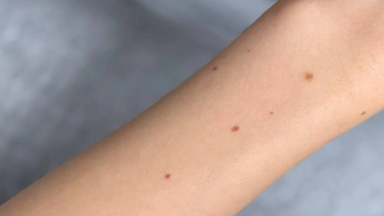 пресс-секретарь ГБУЗ Московской области «МОККВД»