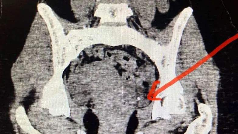 Фото: Долгопрудненская больница
