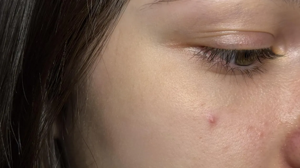 Фото: ГБУЗ МОККВД