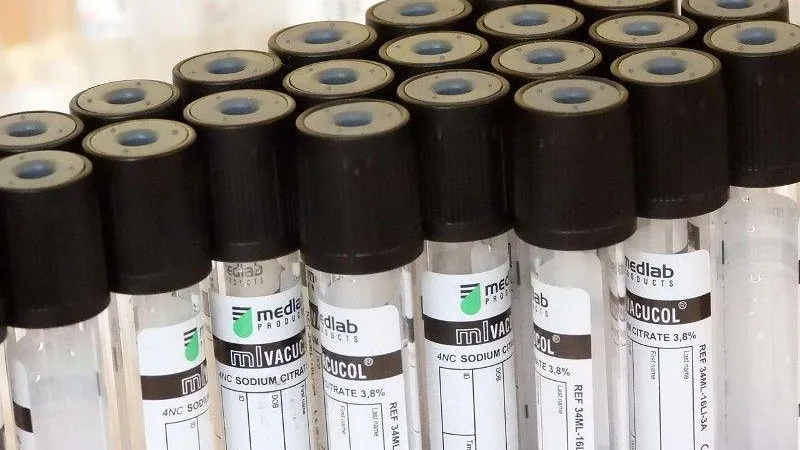 Производство вакуумных пробирок в рамках импортозамещения запустят в Балашихе