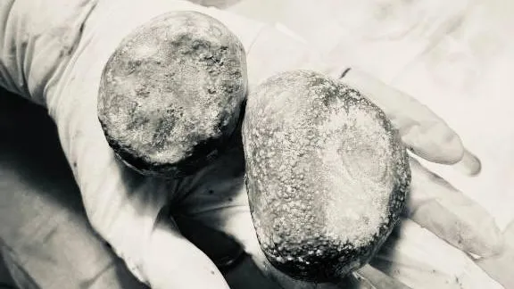 Пресс-служба Минздрава МО