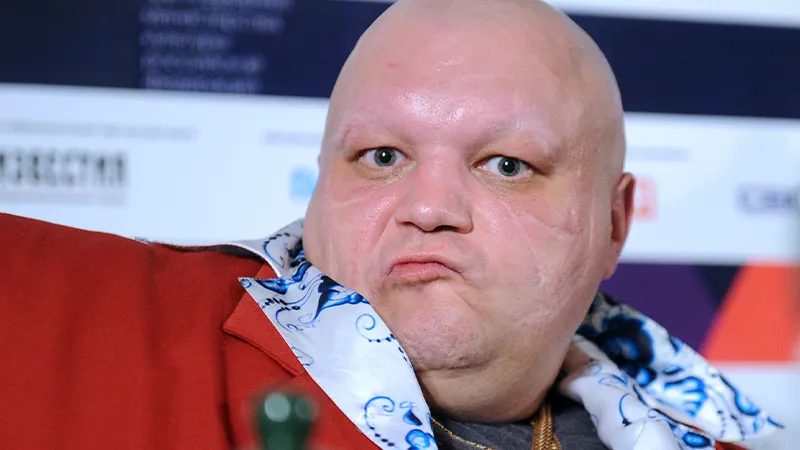 Стас Барецкий рассказал о своих «отношениях» с YouTube