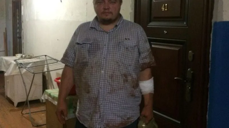 Наркоман искусал подмосковного Ди Каприо