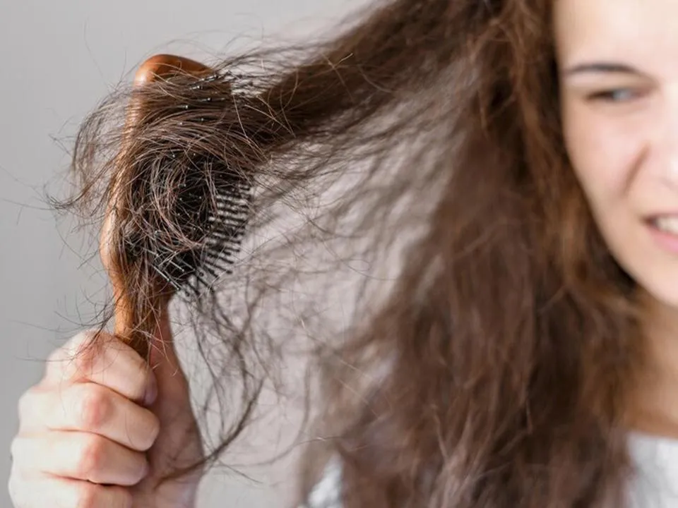 Всему виной стресс: о каких неожиданных проблемах со здоровьем говорит выпадение волос