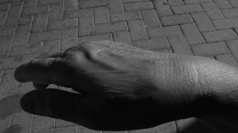 По факту врачебной ошибки, повлекшей ампутацию руки пациента, в Подмосковье возбудили дело
