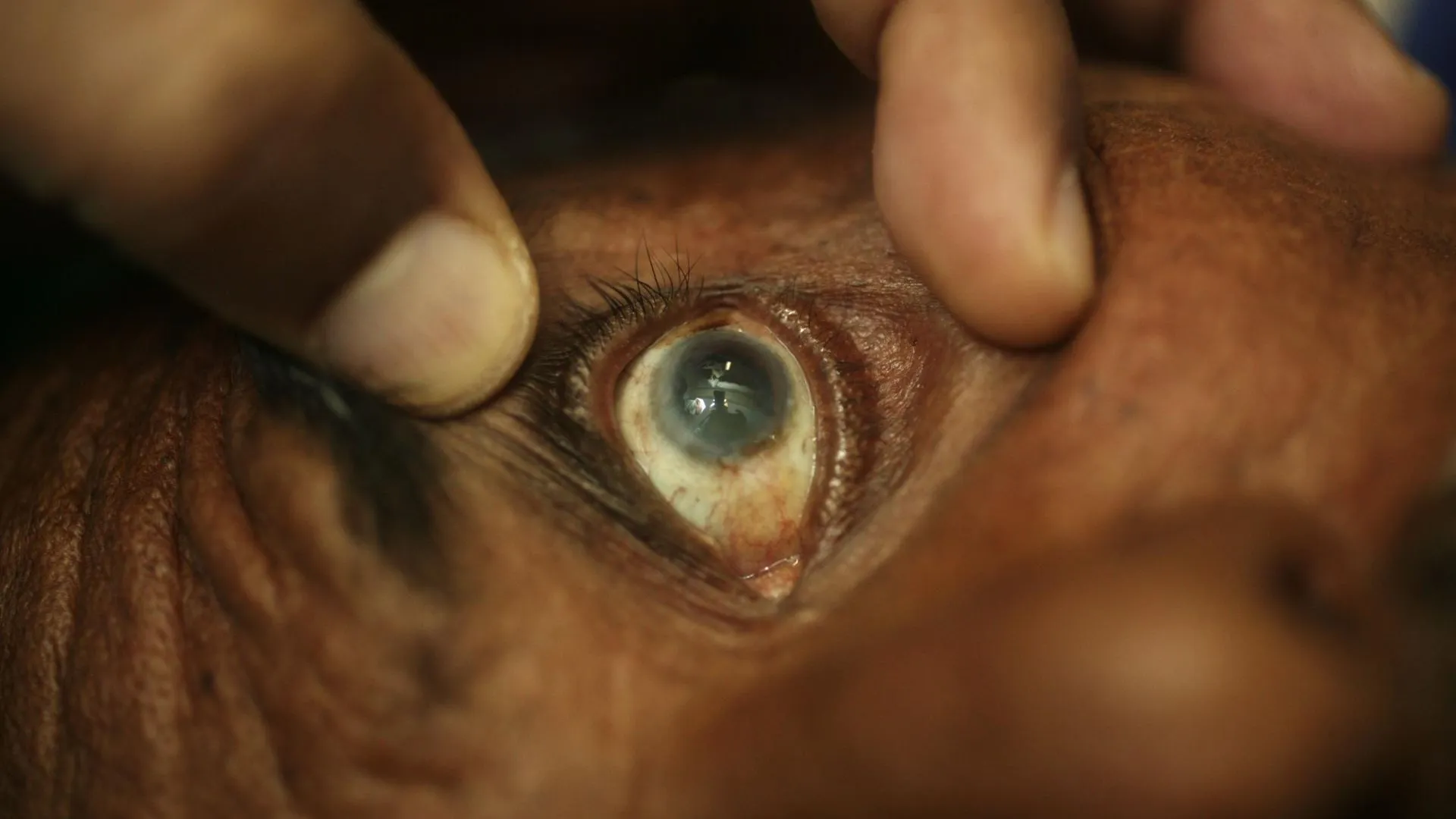 001 Stewart Goldstein/Medicimage/Global Look Press