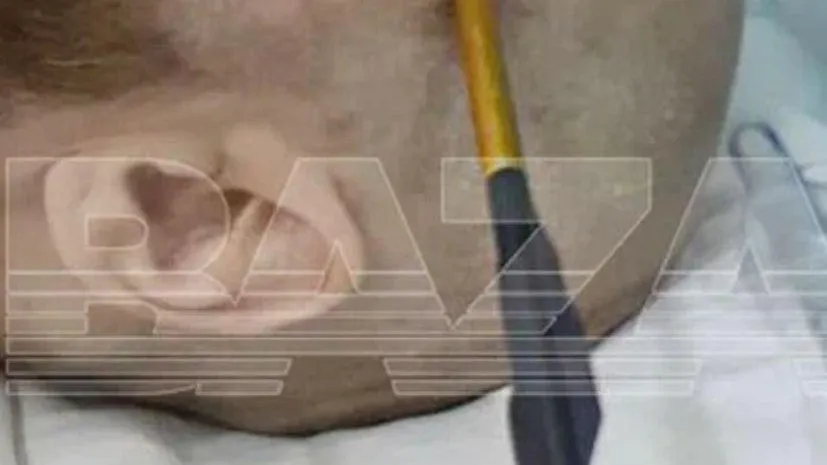 Фото ТГ-канал BAZA