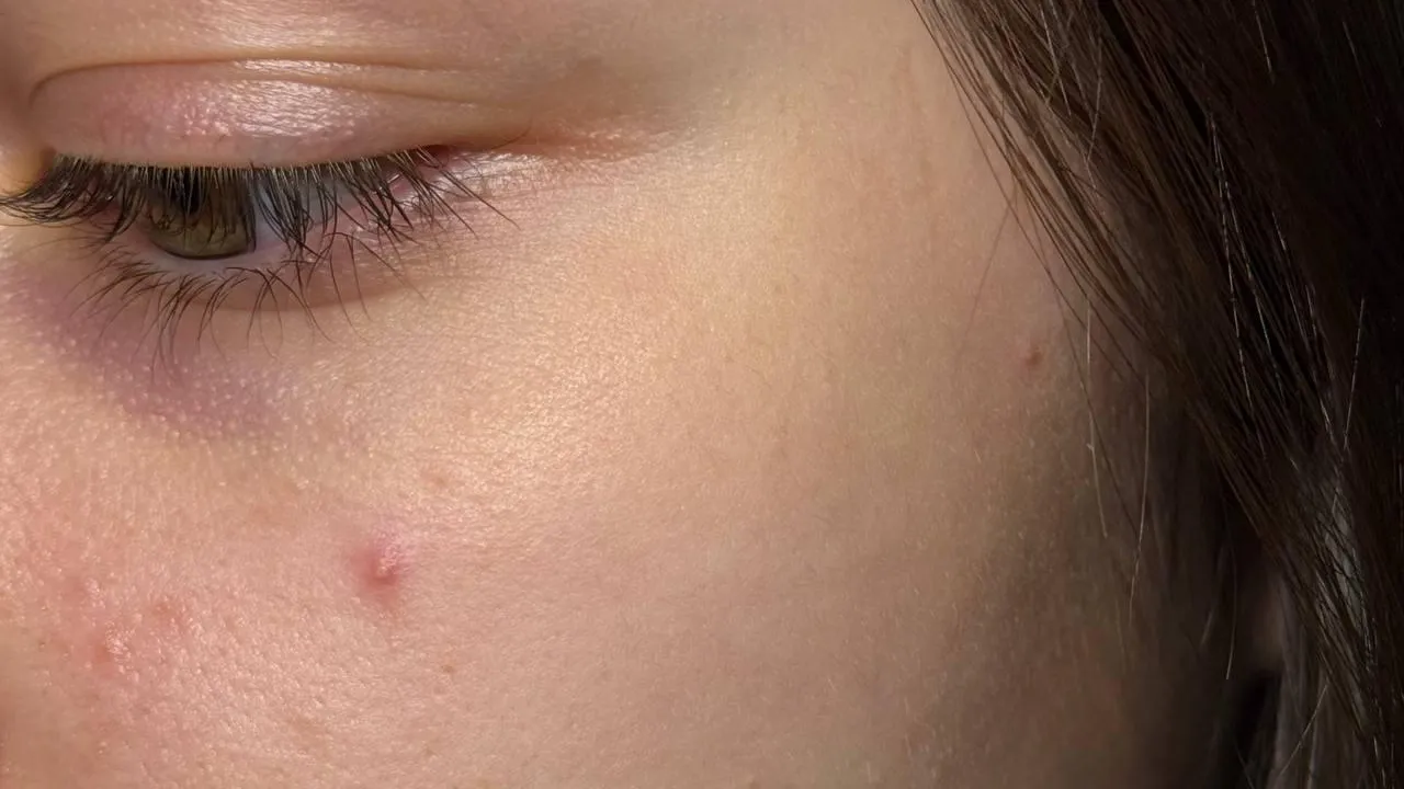 ГБУЗ МО «МОККВД»