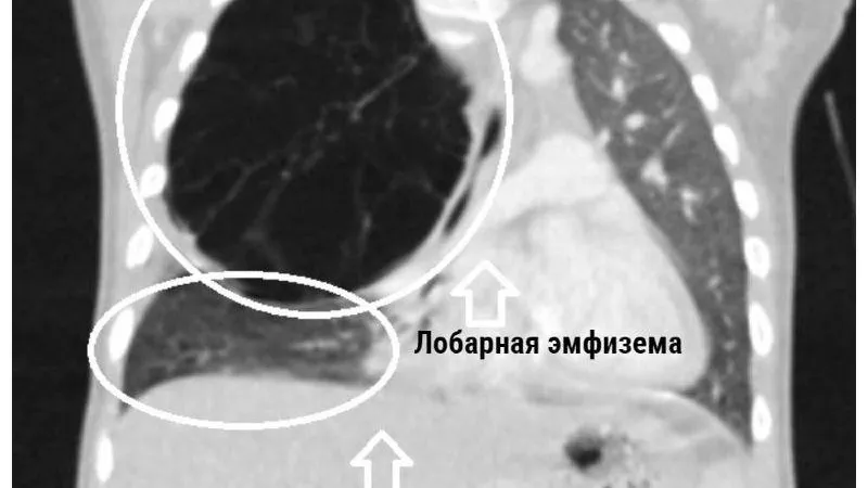 Пресс-служба Министерства здравоохранения МО