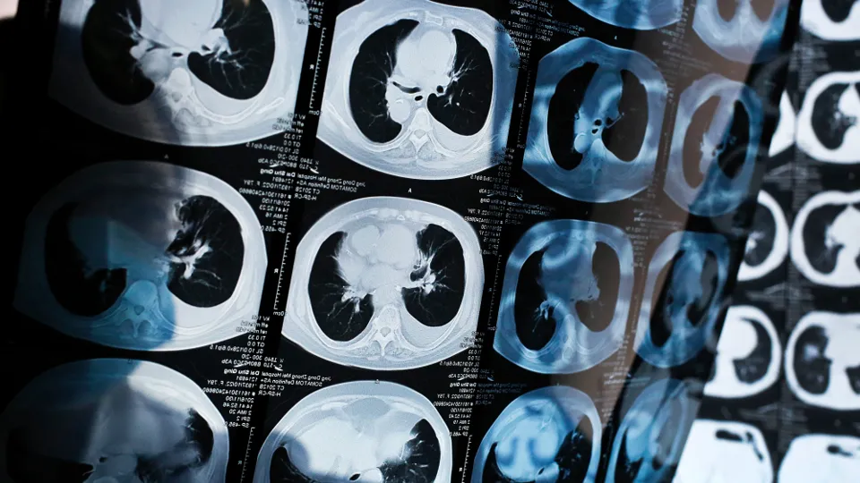 Фото: TASS/AP/Andy Wong