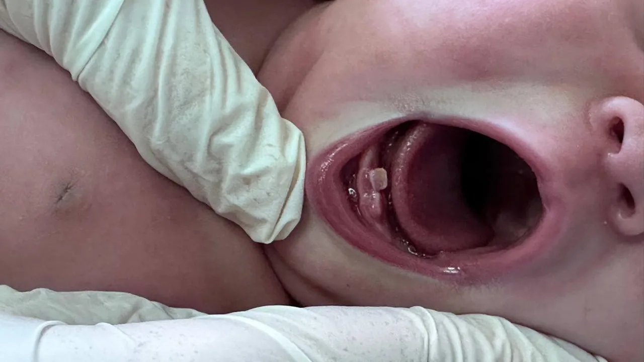 Ребенок с зубами родился в Подмосковье