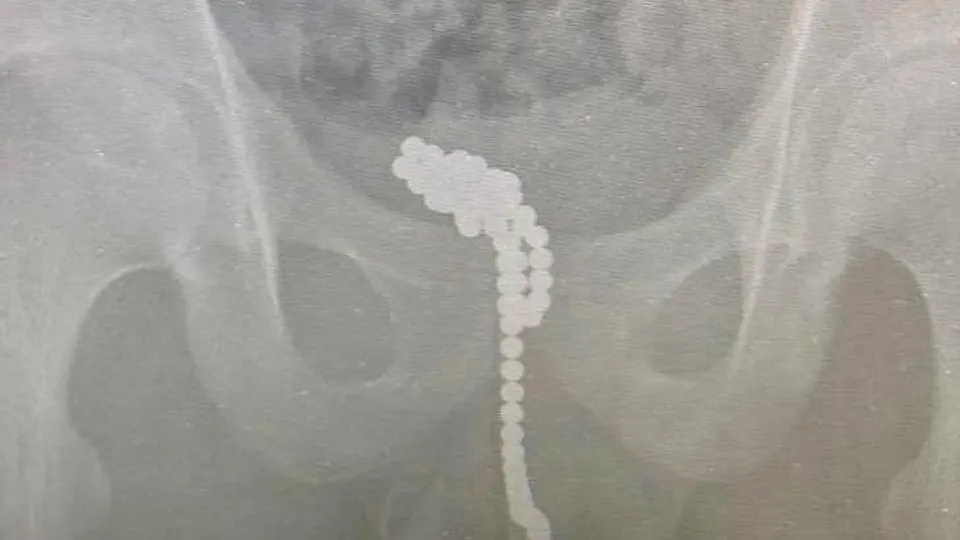 Фото: МОЦОМД