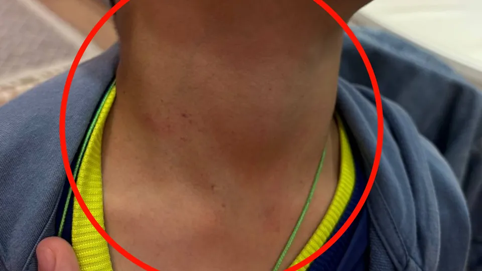 Фото: предоставлено мамой пострадавшего ребенка