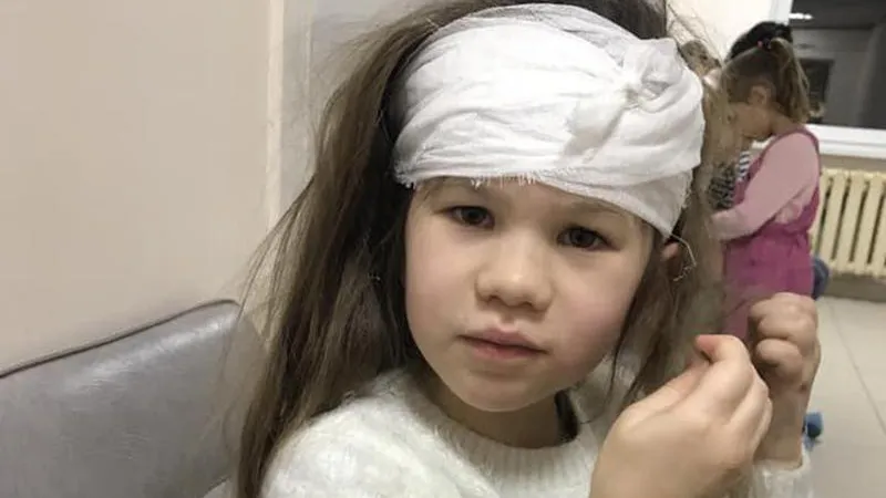 Мать девочки, которой на голову упал кирпич с 12-го этажа, рассказала подробности происшествия