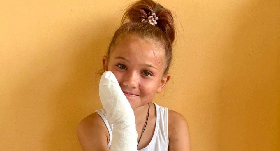 Врачи из Люберец спасли ребенка с ожогами от борщевика