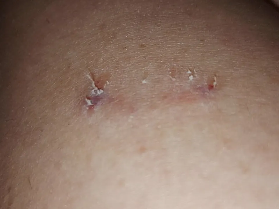 Фото: личный архив пострадавшей